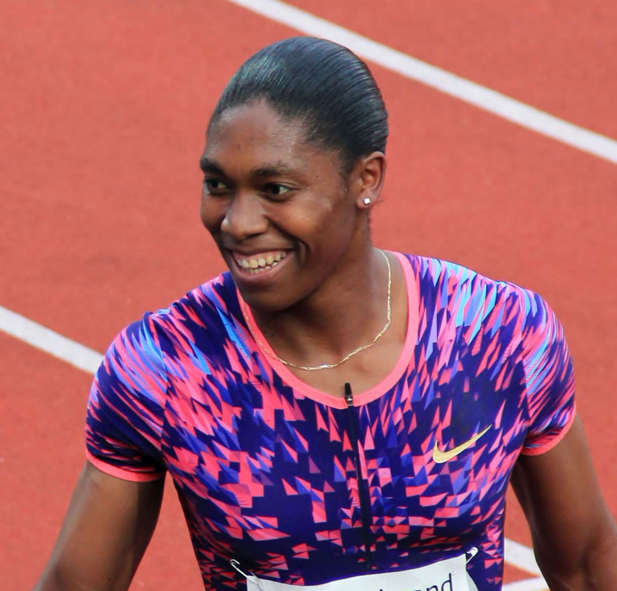 Semenya was assigned female at birth, and she has XY chromosomes.
